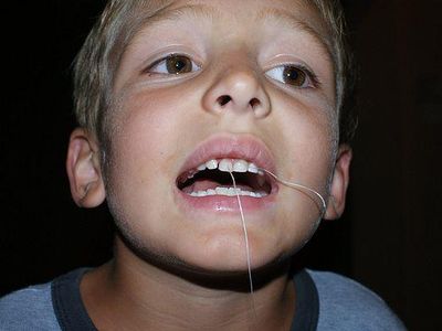 Можно ли самостоятельно удалить зуб?