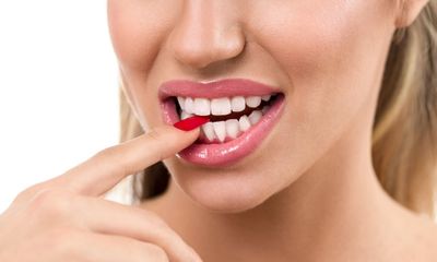 Стираемость зубов