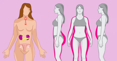 Виды расстройств гормональной системы: гипотиреоидное ожирение, гиперкортизм и прочие