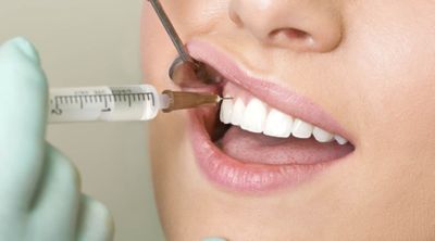 Анестезия при лесении зубов