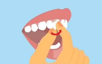Шатание зубов: причины и лечение