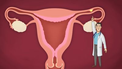Внематочная беременность причины и симптомы